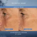 PEPTIDES-BEFOREAFTERS_5000x5000_UBRANDED.webp